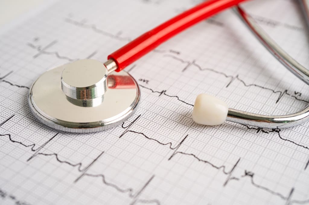 cardiologia_Por chormail_ENVATO_HN_stethoscope-on-electrocardiogram-ecg-heart-wave-2023-11-27-04-58-59-utc