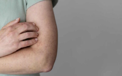 Sociedade Portuguesa de Literacia em Saúde promove webinar sobre MPOX, considerada emergência de saúde pública