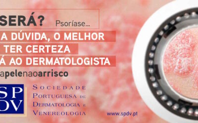 SPDV alerta para importância de um correto diagnóstico