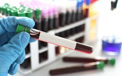 Mpox: Suécia anuncia deteção do primeiro caso do vírus fora de África