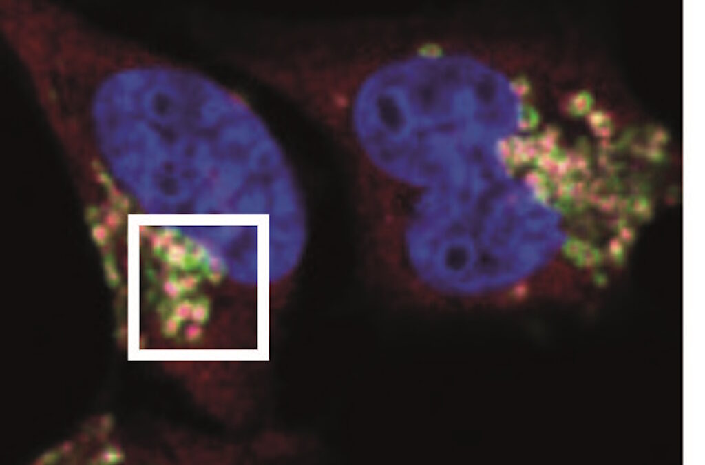 Descoberta de proteína IRGQ abre portas para novas terapias contra o cancro do fígado