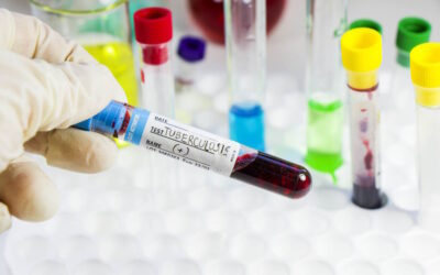 OMS pré-qualifica primeiro teste de diagnóstico da tuberculose