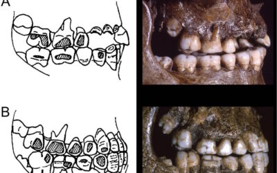 Labrets no Paleolítico Superior: Nova Luz sobre a Modificação Corporal