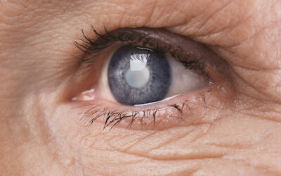 Especialistas alertam para importância do diagnóstico precoce do glaucoma