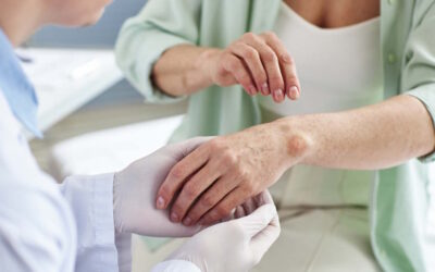 Oito doentes com lepra diagnosticados em 2023 e 2024