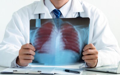 Sociedade Portuguesa de Pneumologia e AstraZeneca desenvolvem estudo inovador sobre a DPOC em Portugal