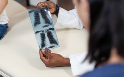 Casos de tuberculose multirresistente duplicaram em 2023