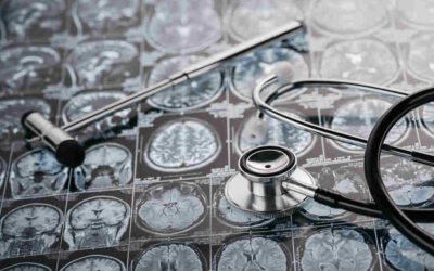 Portugal cria rede nacional de centros clínicos dedicada à doença de Parkinson