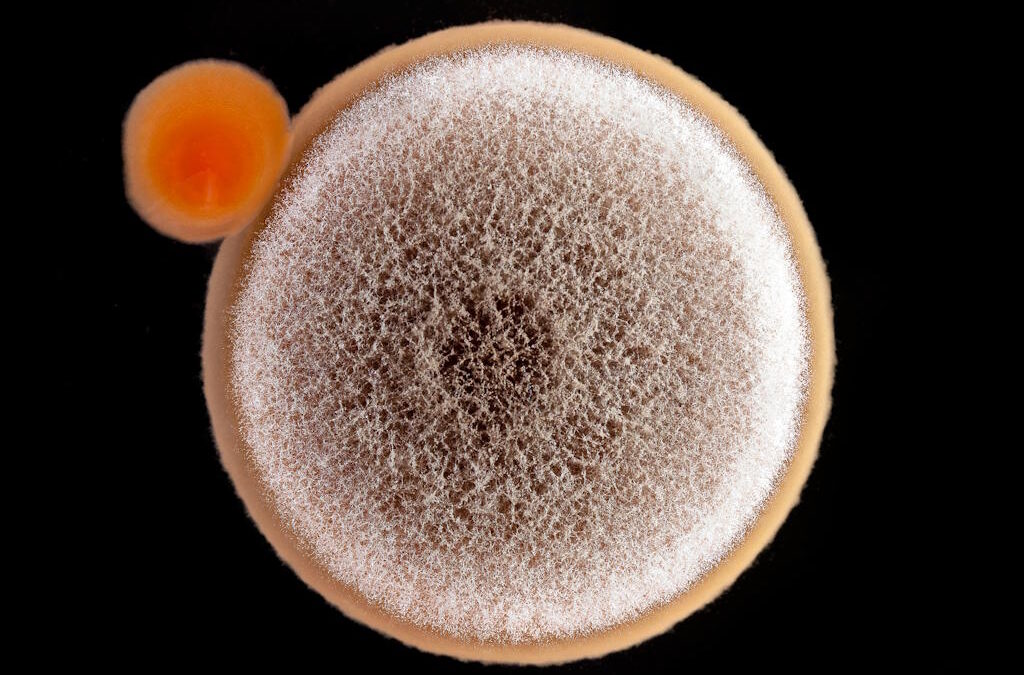 Descoberta de molécula abre caminho a antibióticos seletivos contra a clamídia