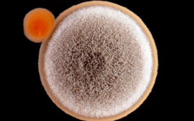 Descoberta de molécula abre caminho a antibióticos seletivos contra a clamídia