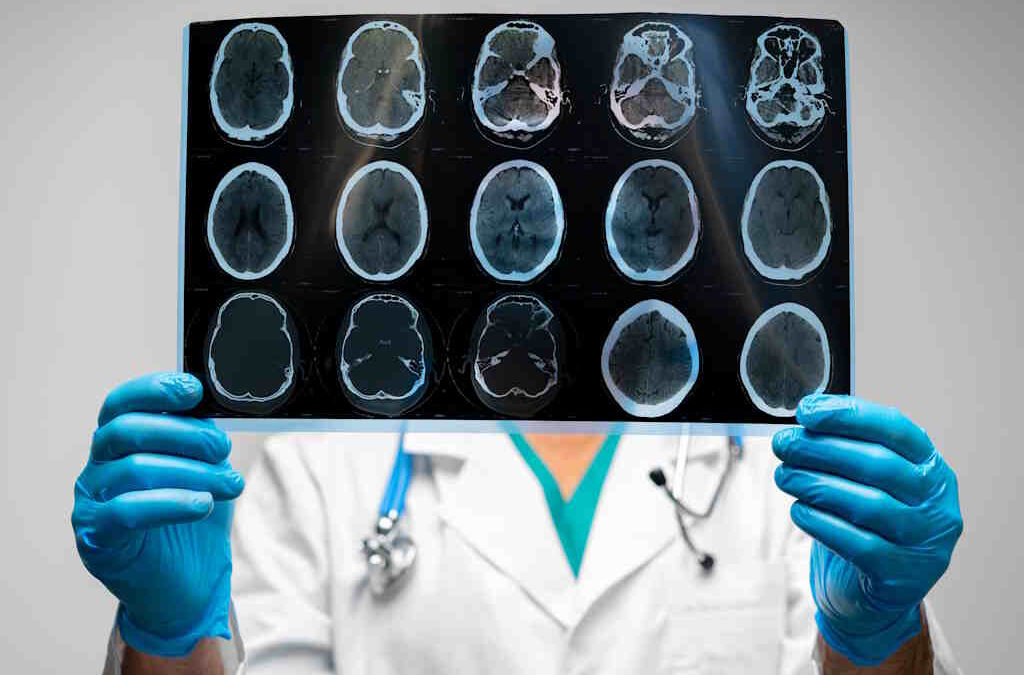 Atrasos no Diagnóstico e Tratamento Comprometem Qualidade de Vida das Pessoas com Esclerose Múltipla