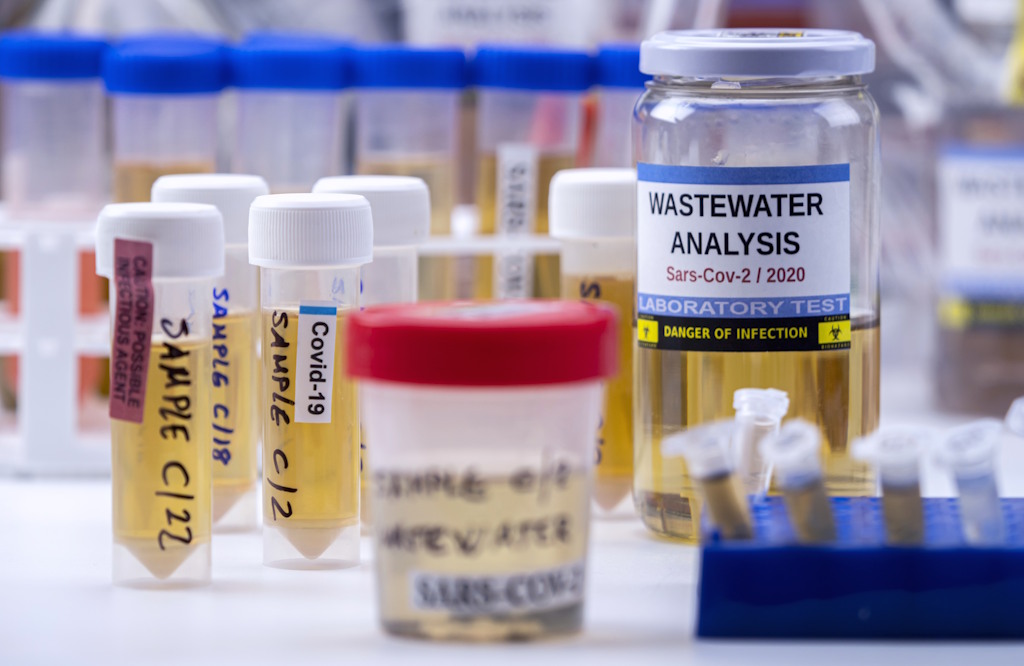 Cientistas detectam genótipos cancerígenos de HPV em esgotos urbanos