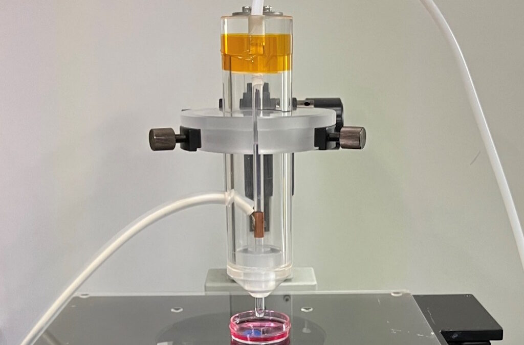 Investigação japonesa revela redução significativa do sarcoma sinovial com plasma ativado