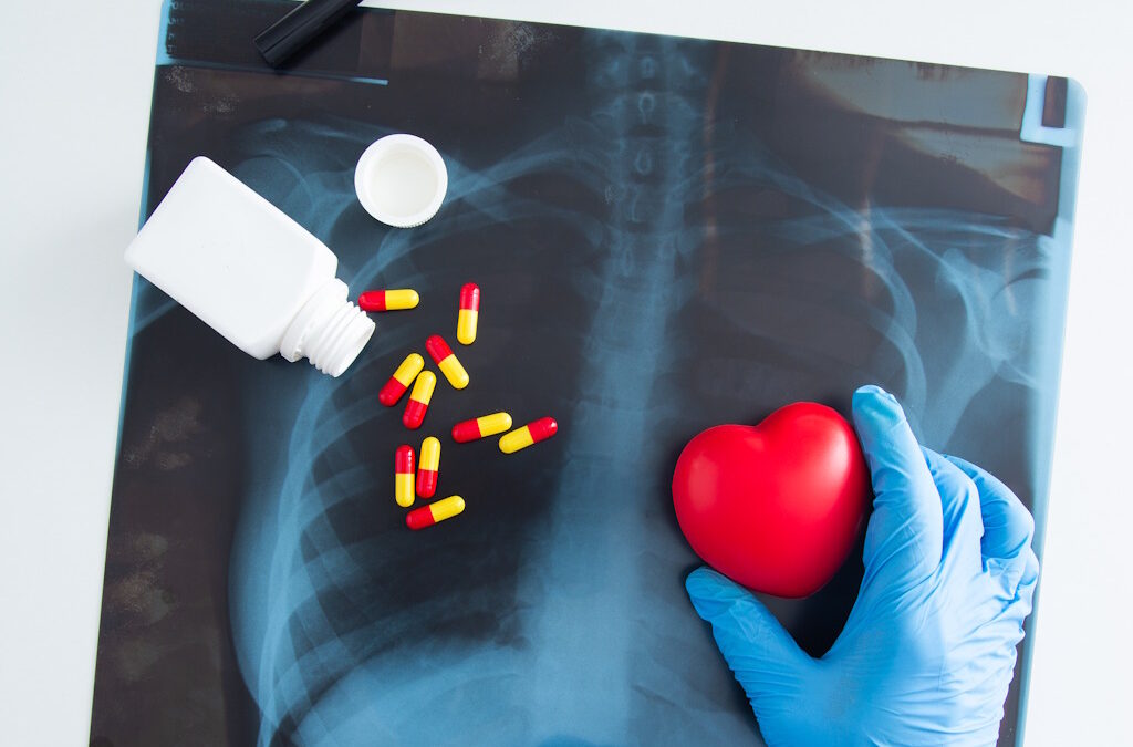 Terapia combinada aumenta esperança de vida em doentes com estenose aórtica e amiloidose cardíaca